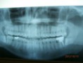 /album/fotogaleria/rx-jpg/